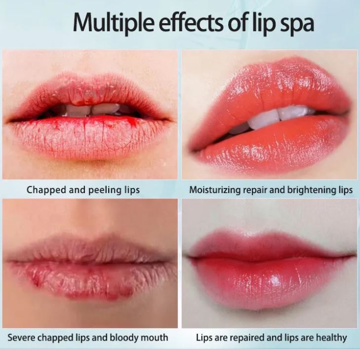 Chapped and Peeling lips, Moisturizing repair and brightening Lips, Healthy and repaired Lips, 24K gold lip mask, gold lip treatment, luxury lip mask, luxurious gold lip therapy, silky soft lips in minutes.
