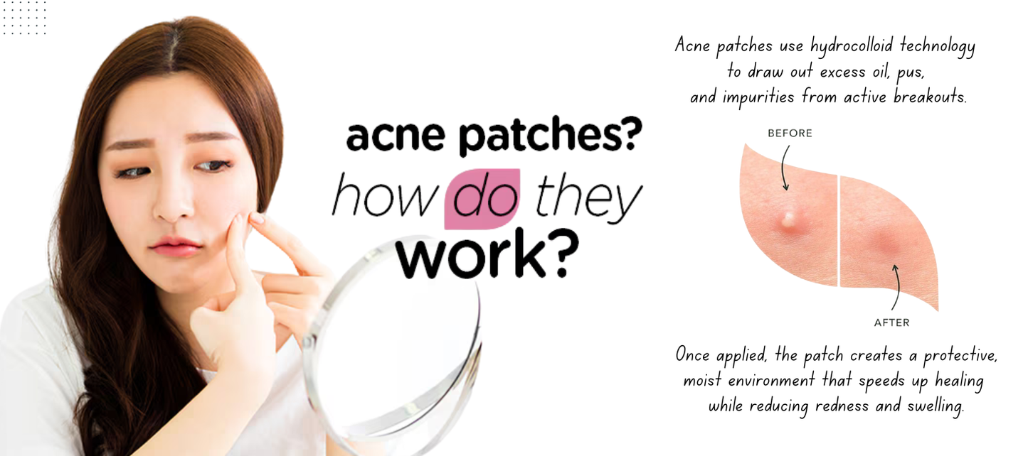 Dots To Spots 36 of 12mm Acne Patches – Rapid Healing Solution by Beauty To Fragrances